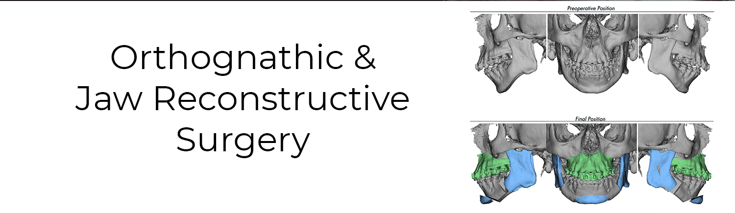 orthognathic & jaw reconstructive surgery