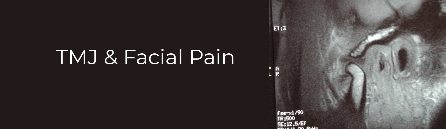 tmj & facial pain